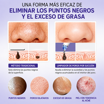 Succionador de poros Clear Skin