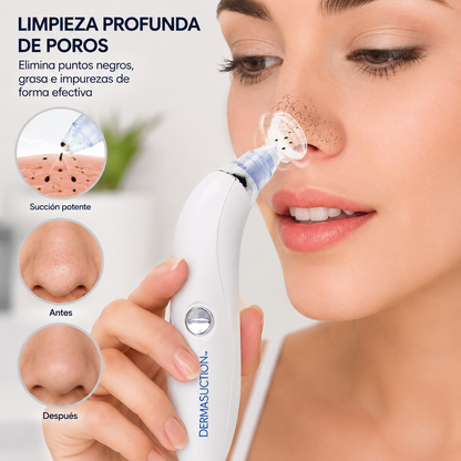 Succionador de poros Clear Skin